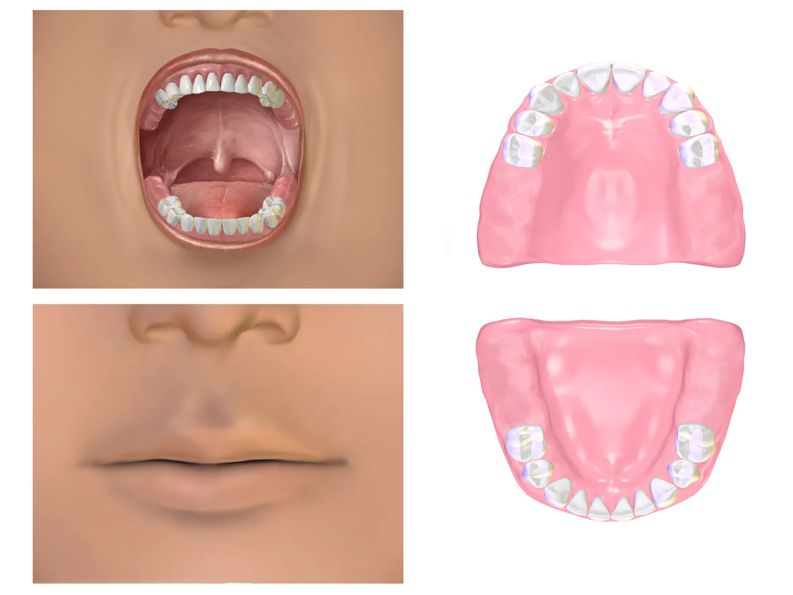 Pediatric dental illustration showing four views of a child's mouth: open mouth with teeth and tongue, maxillary arch, closed mouth, and mandibular arch