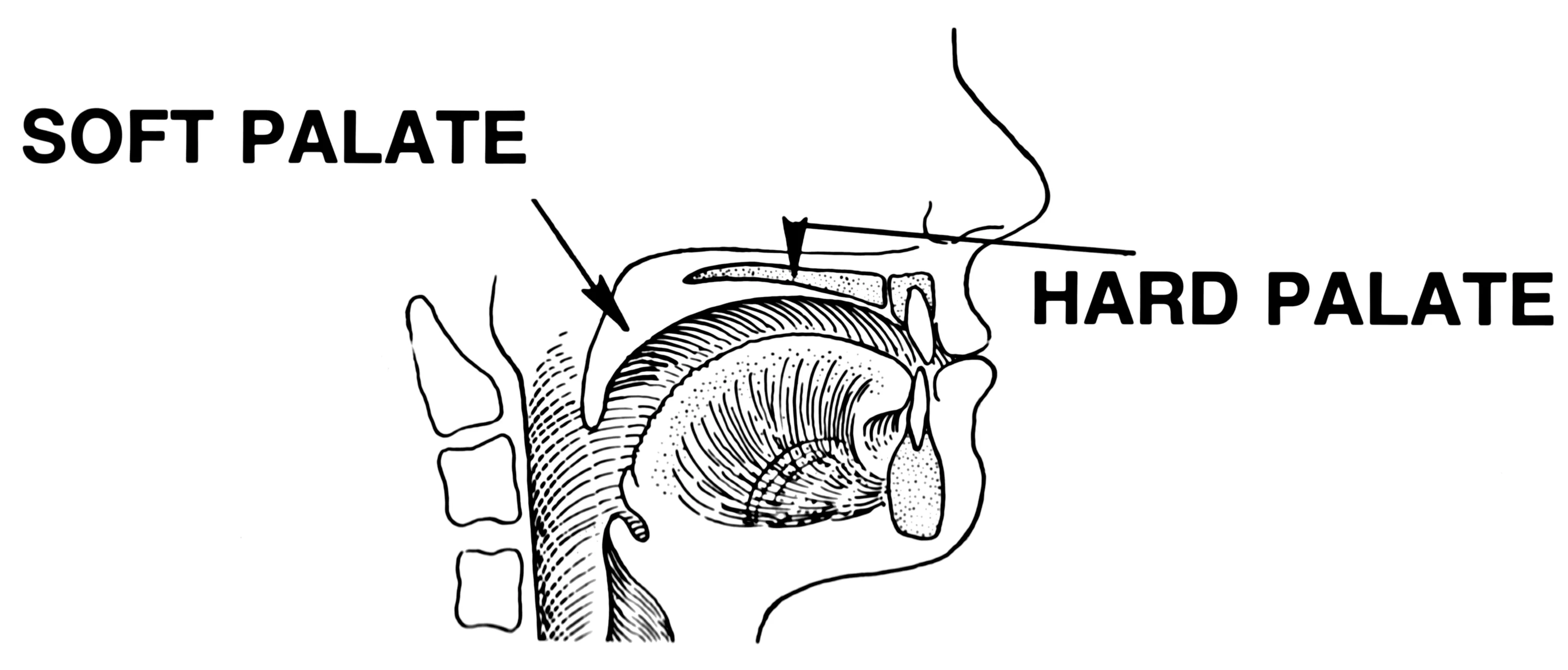 Diagram of the human palate showing the hard palate, soft palate, and uvula
