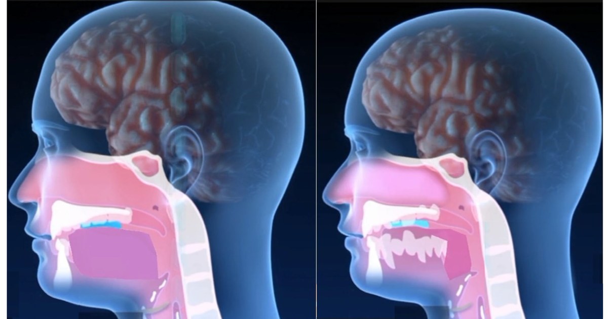 Side-profile anatomical diagram showing adult airway and oral anatomy — illustrating how tongue position affects breathing, swallowing, and the airway.